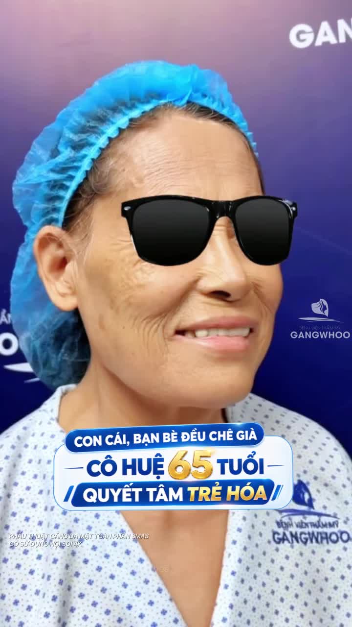 Từ những lời chê bai từ gia đình bạn bè Cô Huệ 65 tuổi quyết tâm phẫu thuật căng da mặt Smas có sử dụng nội soi 4K tìm diện mạo mới trẻ đẹp hơn
