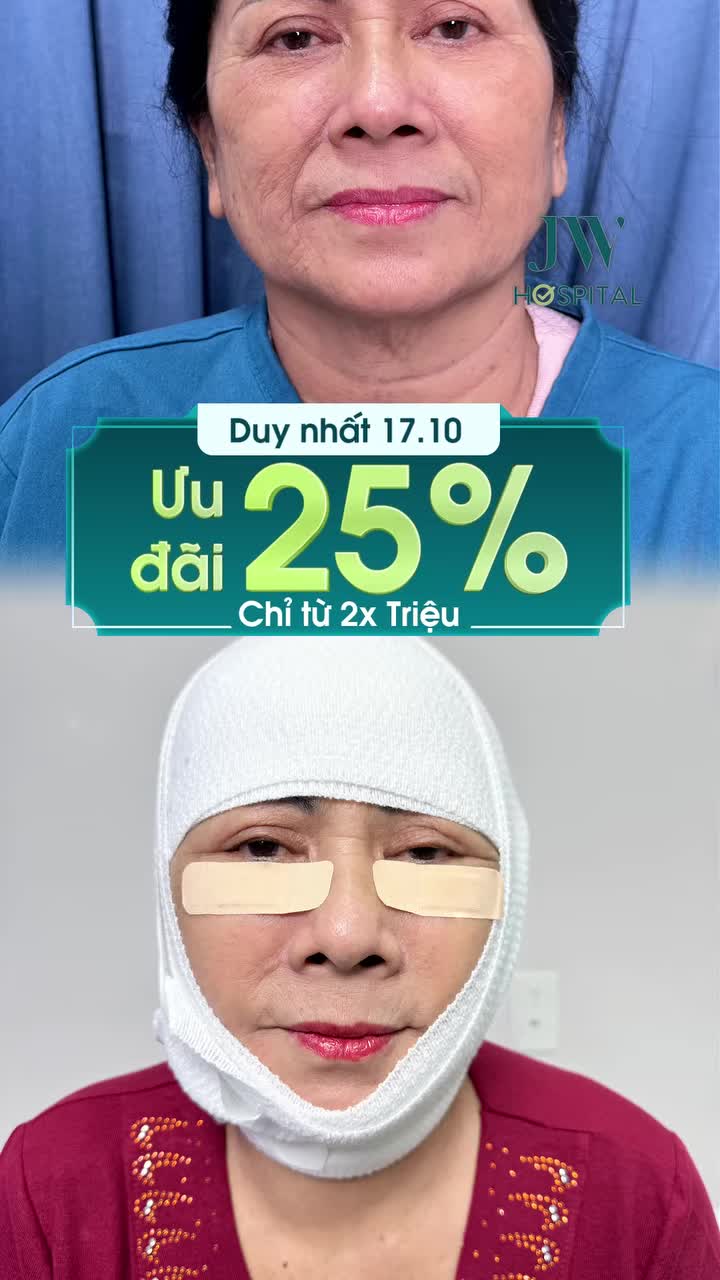 CHỊ EM CHỒNG CHÊ GIÀ XẤU PHẢI LÀM SAO ĐÂY? JW ƯU ĐÃI 25% TRẺ HOÁ MẮT 20 TUỔI KHÔNG SẸO