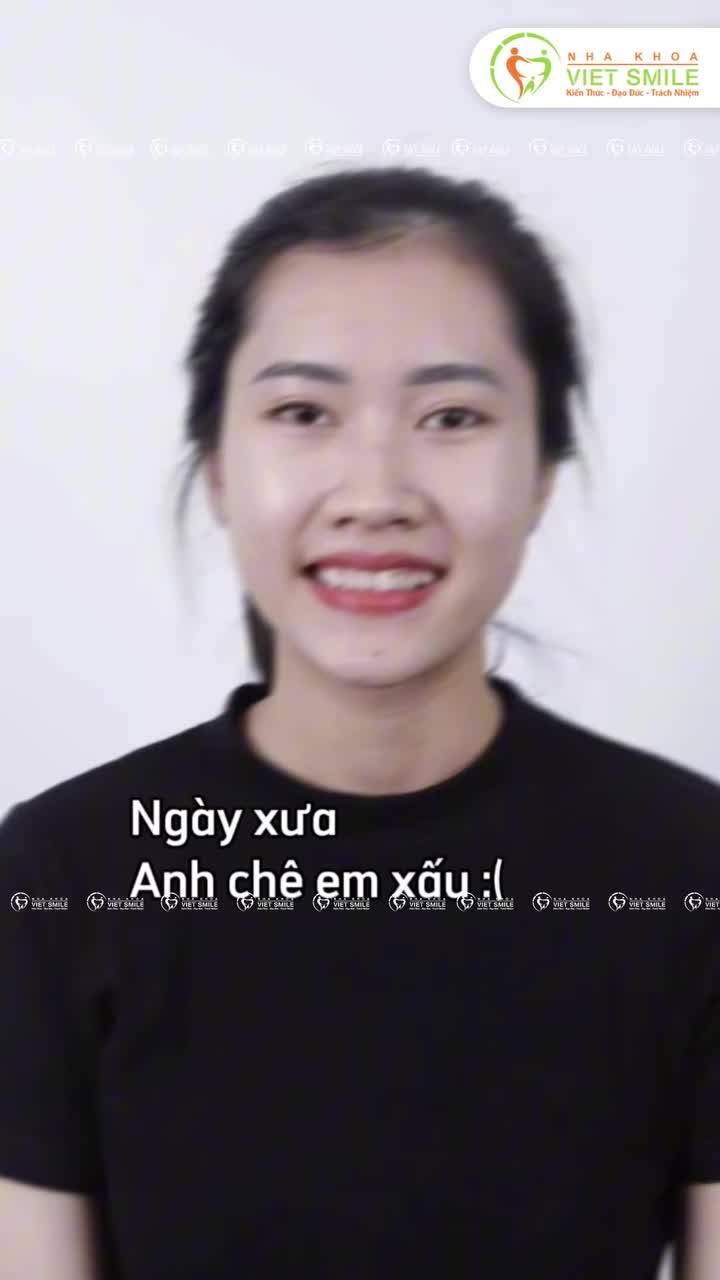 Niềng răng ở Viet Smile đảm bảo NYC của bạn sẽ hối hận đó ! Cùng thay đổi với chúng tôi nhé