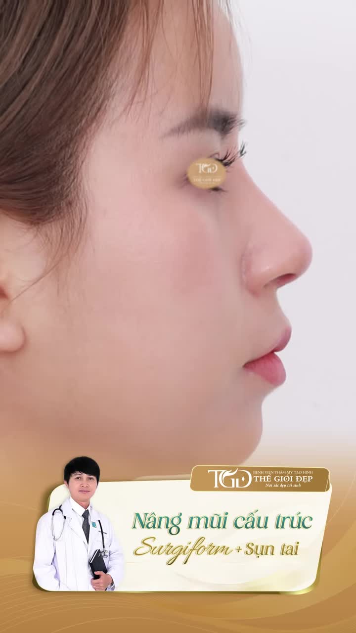 Da đầu mũi mỏng sụn tai có phải là lựa chọn tốt nhất