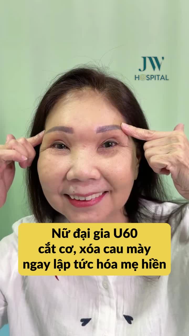 NỮ ĐẠI GIA U60 MẶT NGHIÊM NGHỊ ĐẾN JW XÓA SẠCH CAU MÀY NỘI SOI, DIỆN MẠO HIỀN HÒA TƯƠI TRẺ SAU 60 PHÚT, SẸO VÔ HÌNH