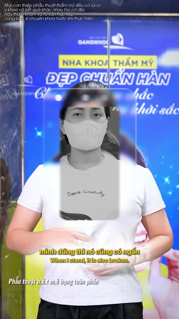 Mất 2 năm chần chừ vì sợ, nay đã hài lòng vì kết quả ưng ý sau giảm mỡ tại BVTM Gangwhoo