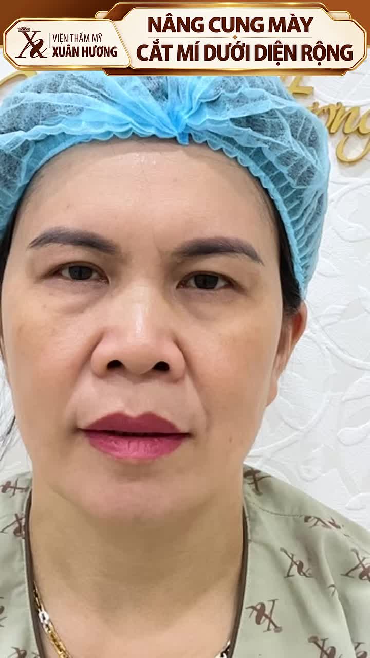 ÁNH NHÌN RẠNG RỠ – THẦN THÁI THĂNG HOA