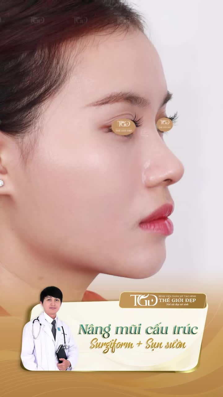 Dáng mũi thay đổi không nhận ra