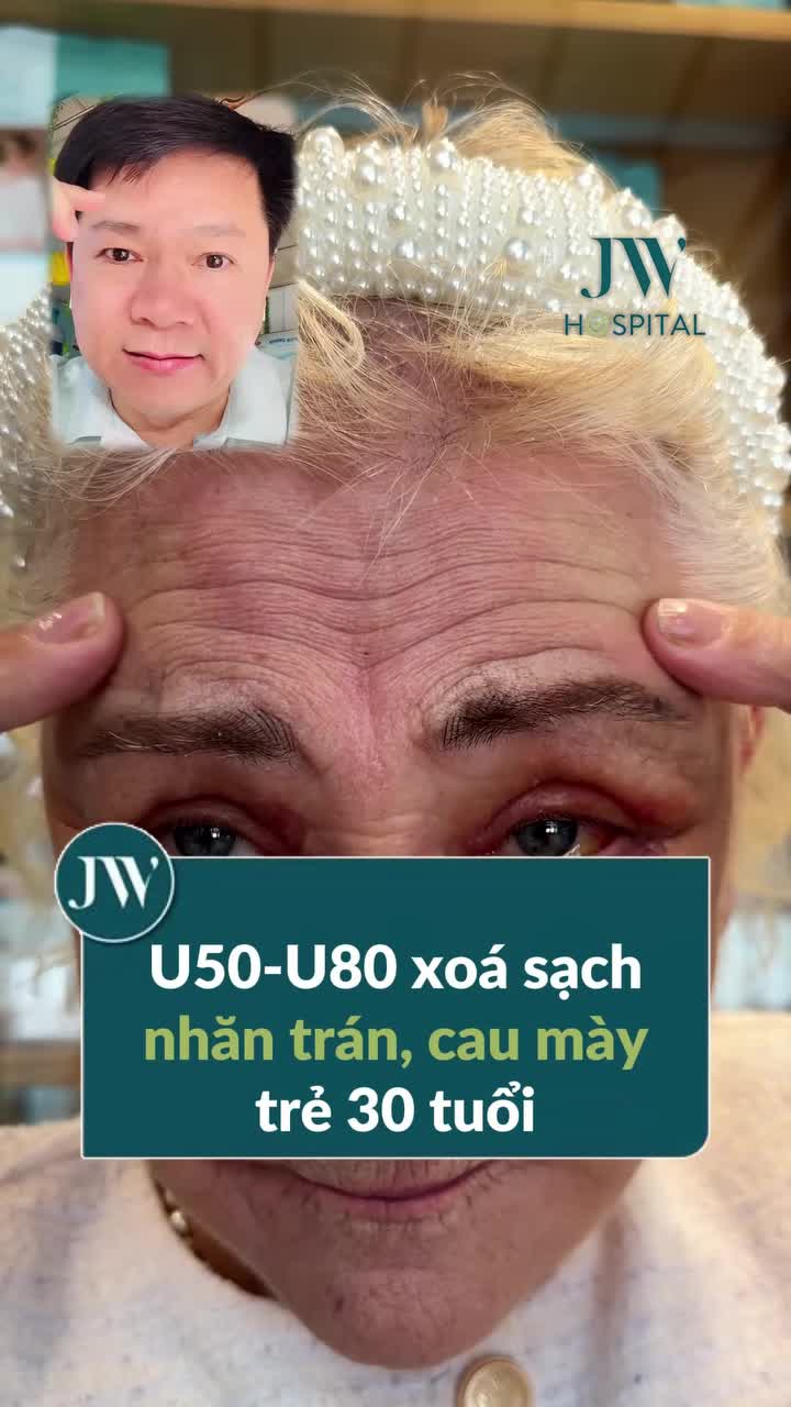 BÁC SĨ TÚ DUNG GIÚP U50-U80 XỬ LÝ TRIỆT ĐỂ NẾP NHĂN TRÁN, RÃNH CAU MÀY SÂU, TRẺ LIỀN 30 TUỔI