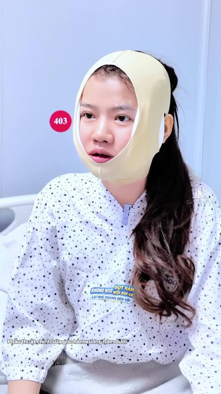 Chị khách bất ngời sau thực hiện không nghĩ gọt hàm có sử dụng nội soi 4K lại nhẹ nhàng và không đau đến vậy