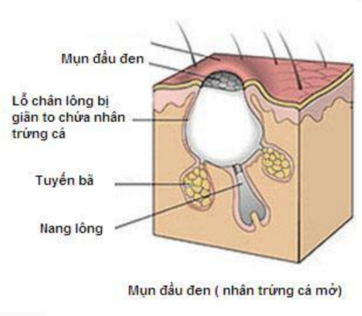 mun dau den