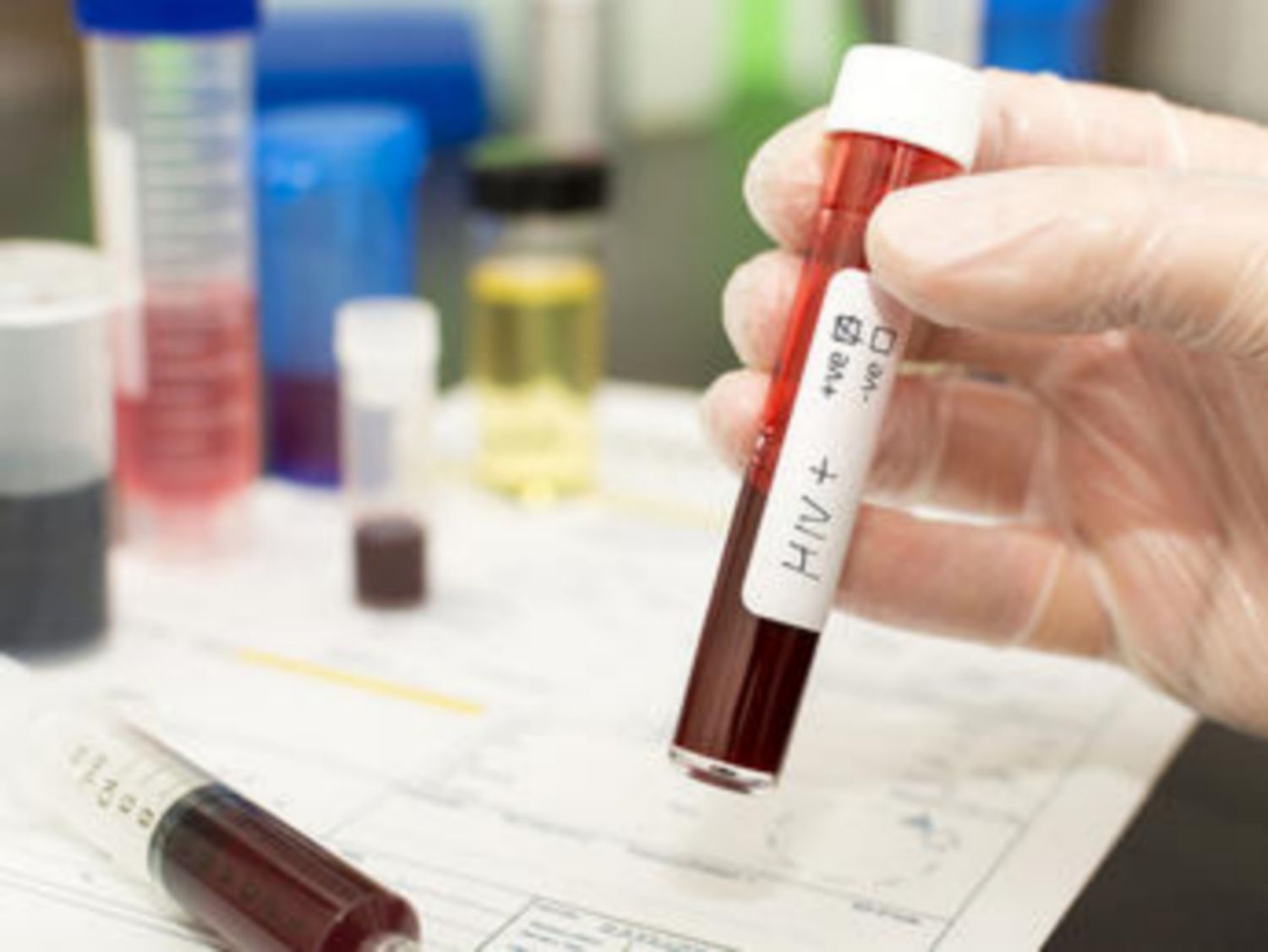Nhiễm HIV/AIDS trong thai kỳ