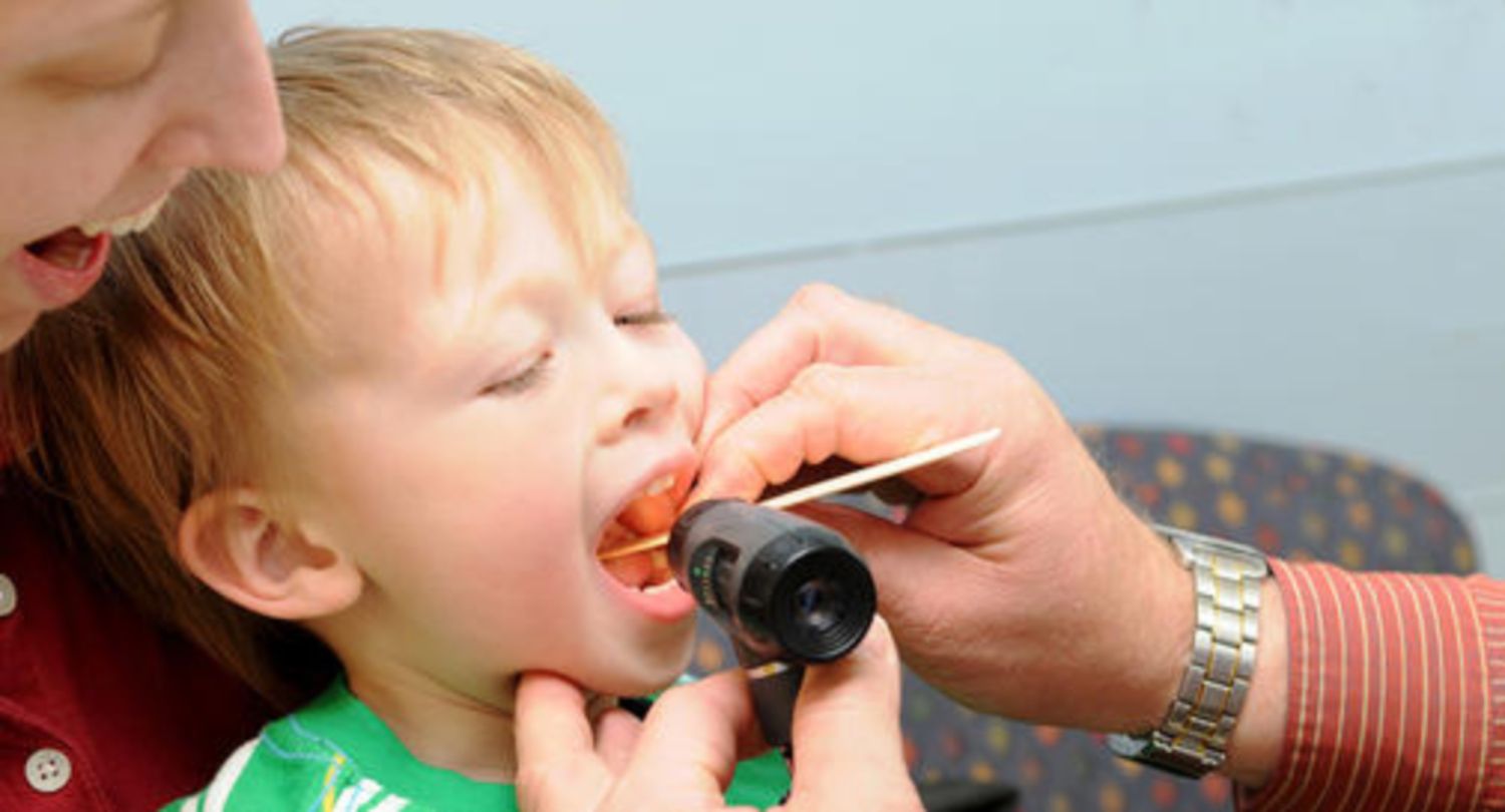 Viêm họng do liên cầu khuẩn (strep) và cách phòng ngừa