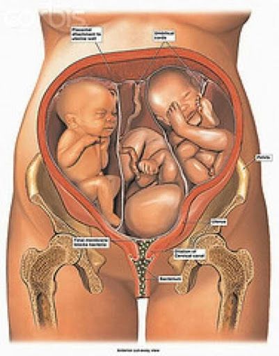 Khả năng mang thai đôi hoặc đa thai của bạn