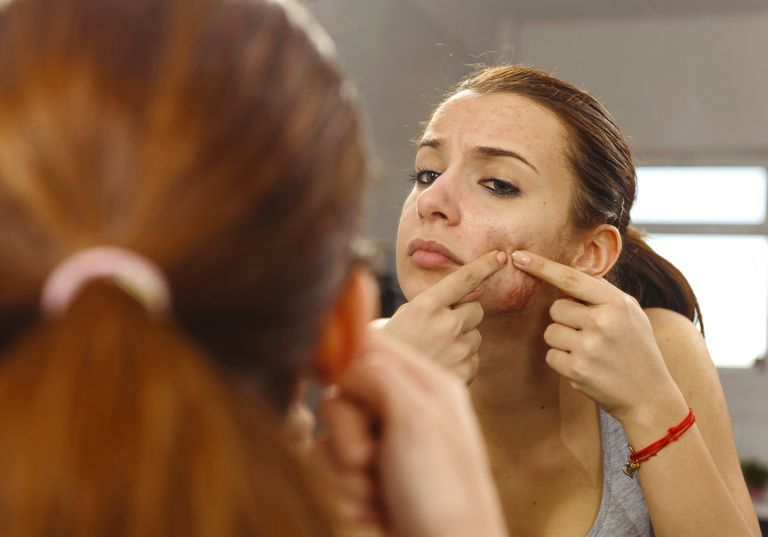 Có nên dùng Isotretinoin để điều trị mụn trứng cá trong khi mang thai?