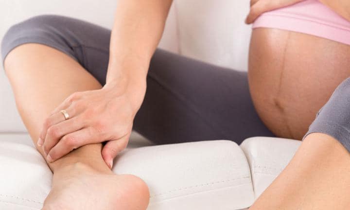 Giãn tĩnh mạch trong thai kỳ