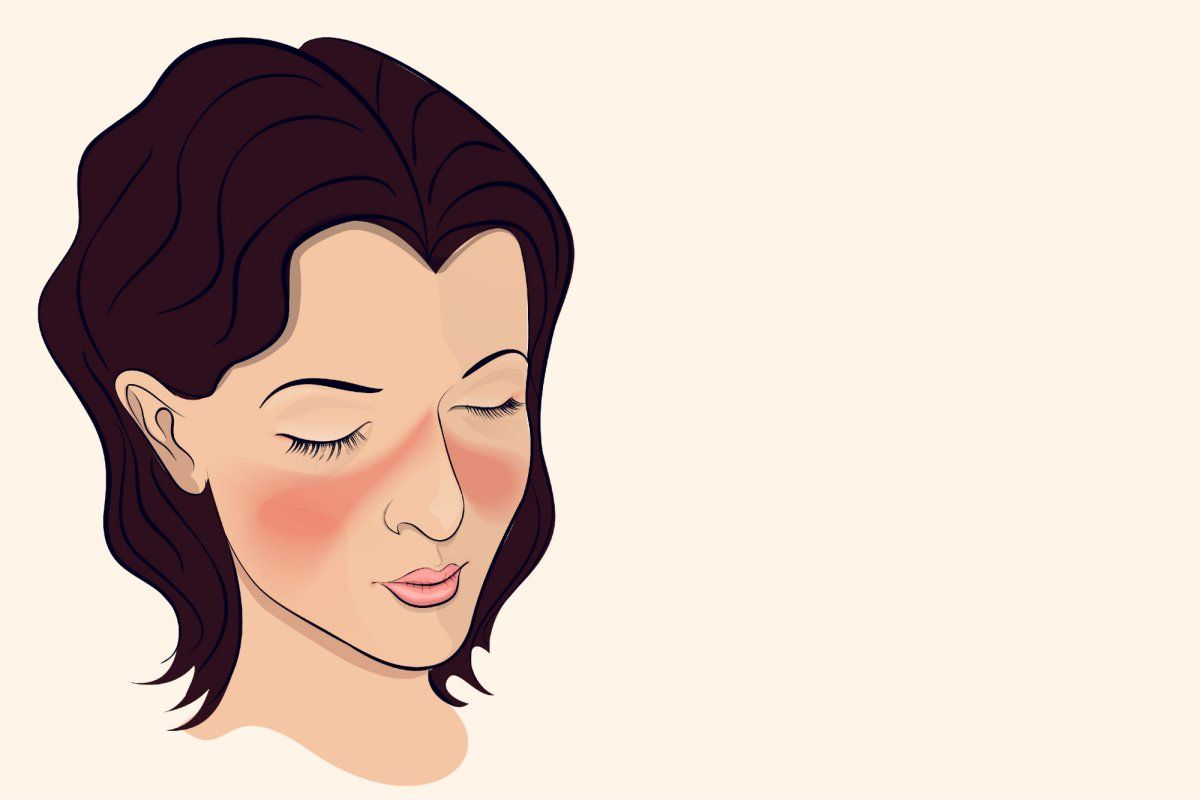 Bệnh lupus ban đỏ ảnh hưởng đến thai nhi như nào?