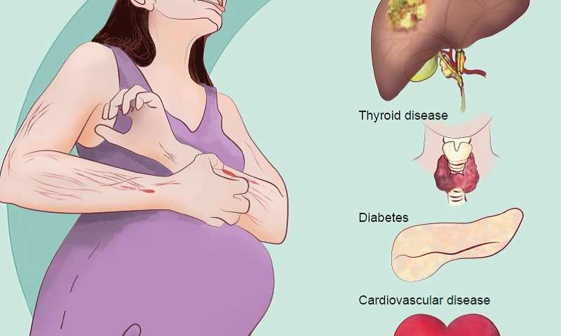 Chứng ứ mật thai kỳ và cách điều trị