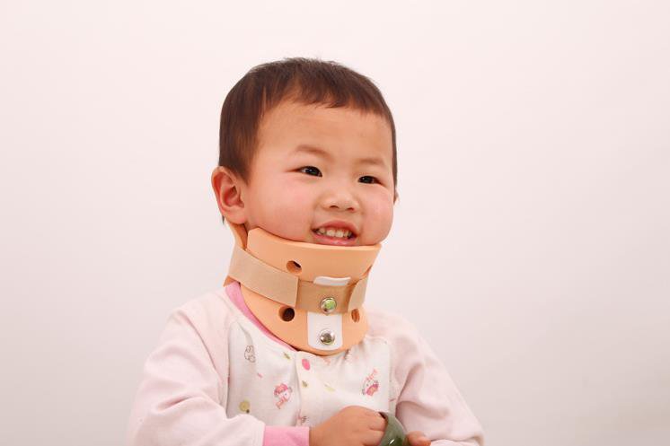 Vẹo cổ ở trẻ nhỏ
