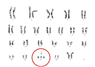 Karyotyping – Nhiễm sắc thể đồ - Bệnh viện Từ Dũ