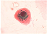 Cytomegalo Virus - Bệnh viện Từ Dũ
