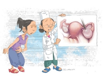 U nang buồng trứng