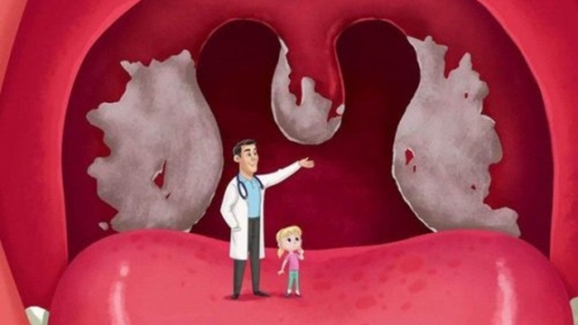 Tìm hiểu về bệnh Bạch hầu