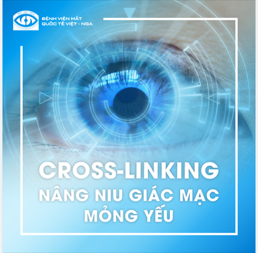 CROSS-LINKING: BẢO VỆ GIÁC MẠC TOÀN DIỆN
