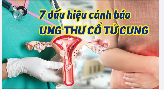 PHÁT HIỆN UNG THƯ CỔ TỬ CUNG - ĐỪNG ĐỂ QUÁ TRỄ!