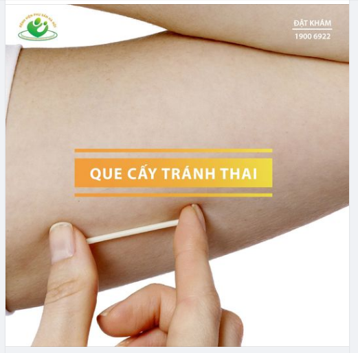Que cấy tránh thai có phải biện pháp tránh thai hiệu quả