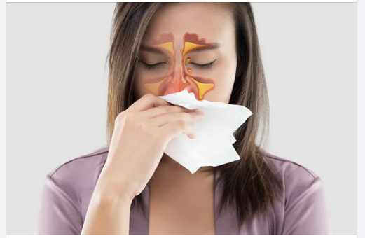 TÌM HIỂU KỸ THUẬT CHẨN ĐOÁN BỆNH MŨI XOANG TẠI MEDLATEC