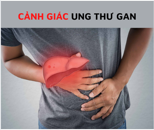 UNG THƯ GAN  "SÁT THỦ THẦM LẶNG" KHÔNG TRỪ MỘT AI