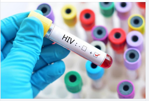 XÉT NGHIỆM HIV HẾT BAO NHIÊU TIỀN, BẠN ĐÃ BIẾT CHƯA??