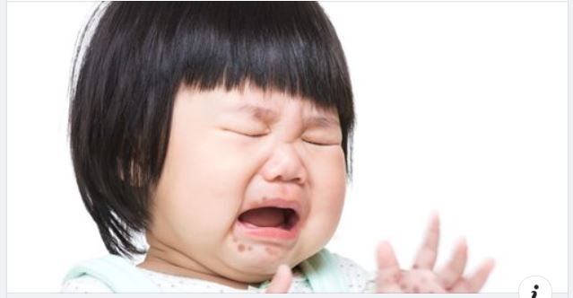TAY CHÂN MIỆNG BÙNG PHÁT "BÁO ĐỘNG" Ở TRẺ - LÀM SAO ĐỂ PHÒNG TRÁNH?