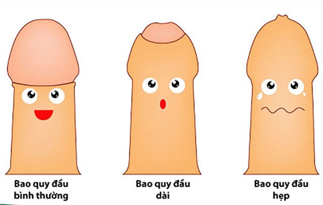 Dấu hiệu của hẹp bao quy đầu ở trẻ