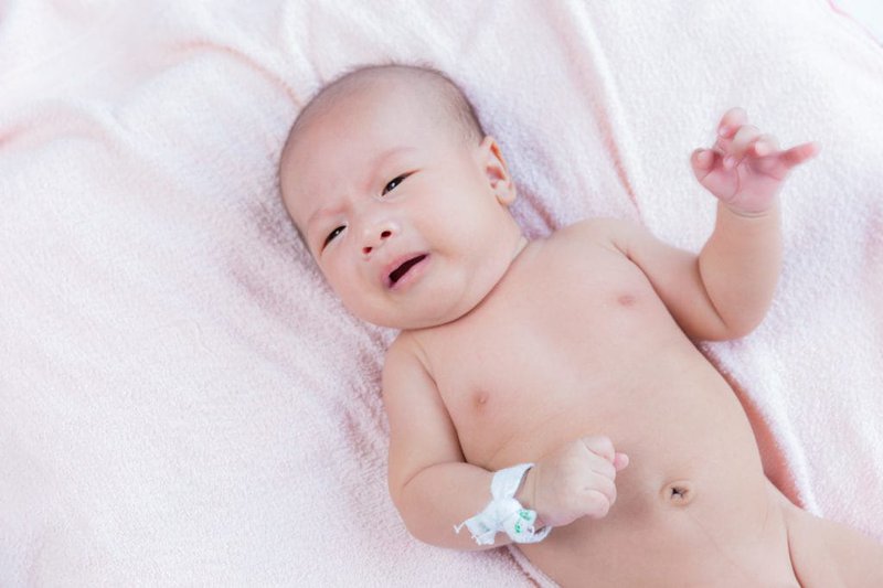 Thoát vị rốn ở trẻ em: Những điều cần biết