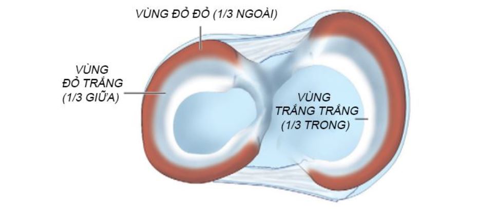 Rách sụn chêm khớp gối khi nào cần phẫu thuật - bệnh viện Việt Đức