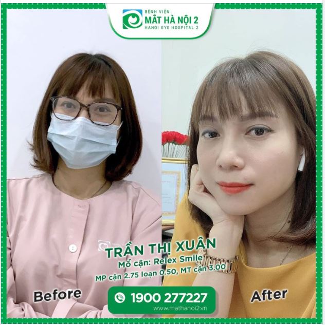 CHỈ 1 CÂU NÓI "BIẾT THẾ NÀY MỔ CẬN LÂU RỒI