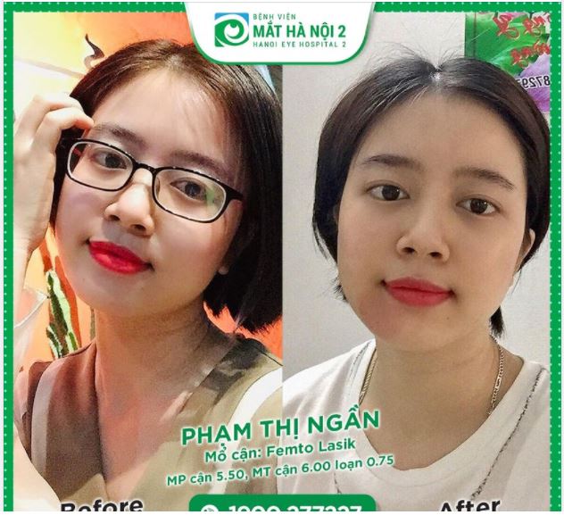 BÁC SĨ Y HỌC CỔ TRUYỀN LỰA CHỌN MẮT HÀ NỘI 2 ĐỂ MỔ CẬN