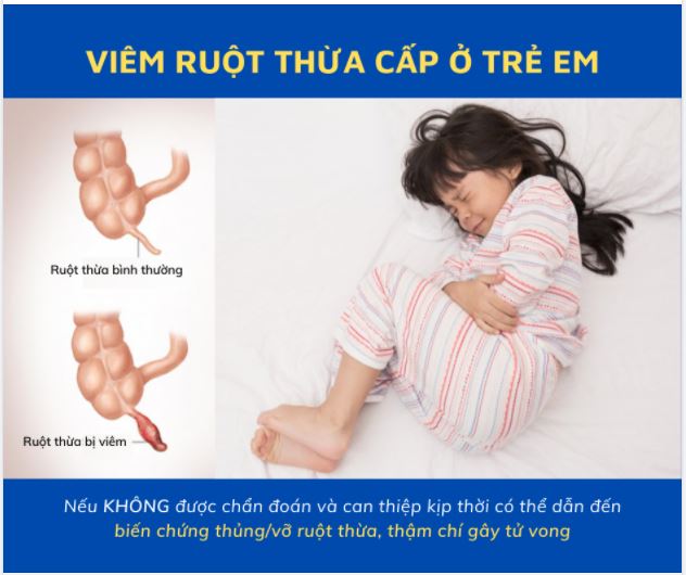 TRẺ BỊ ĐAU BỤNG - CẨN TRỌNG VIÊM RUỘT THỪA CẤP NGUY HIỂM