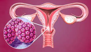 Vắc-xin HPV: Ai nên tiêm và tiêm khi nào?