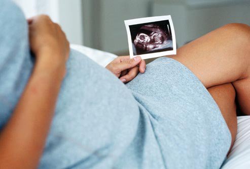 Mang thai có được tiêm phòng vắc-xin viêm não Nhật Bản?