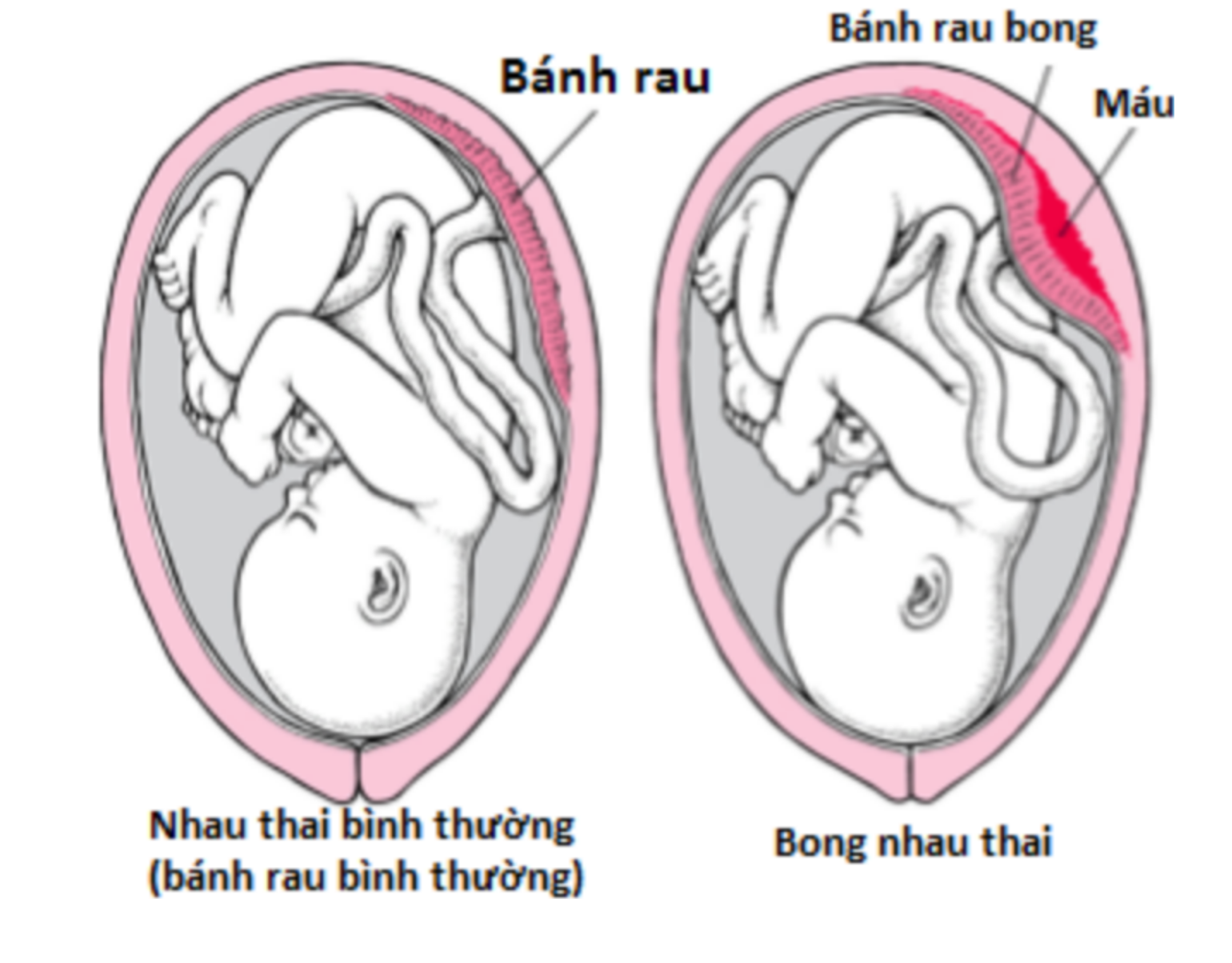 Bị ngã khi đang mang thai có đáng lo?