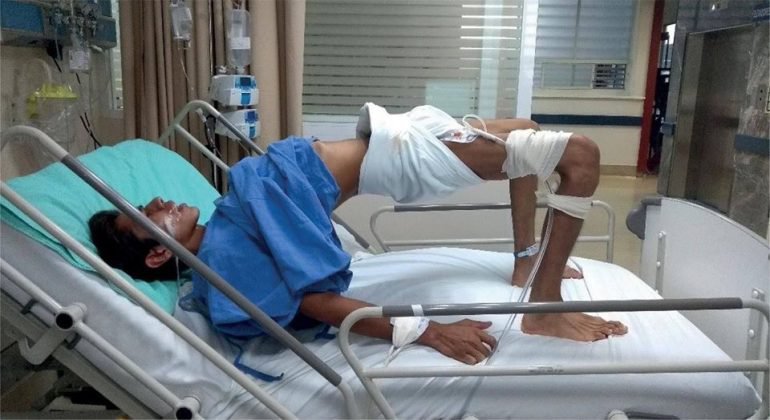 Tiêm phòng uốn ván có tác dụng trong bao lâu?