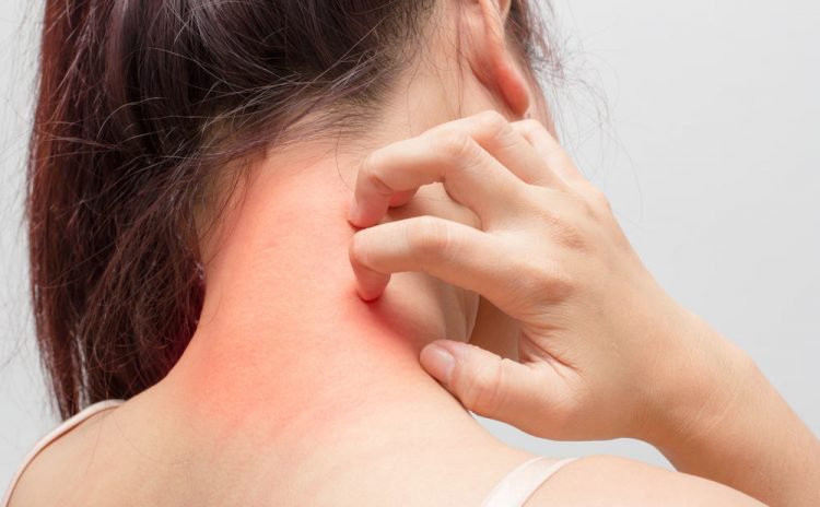 Phản ứng dị ứng có thể xảy ra sau khi tiêm huyết thanh