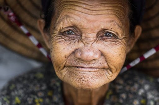 Tại sao da của bạn bị nhăn nheo?