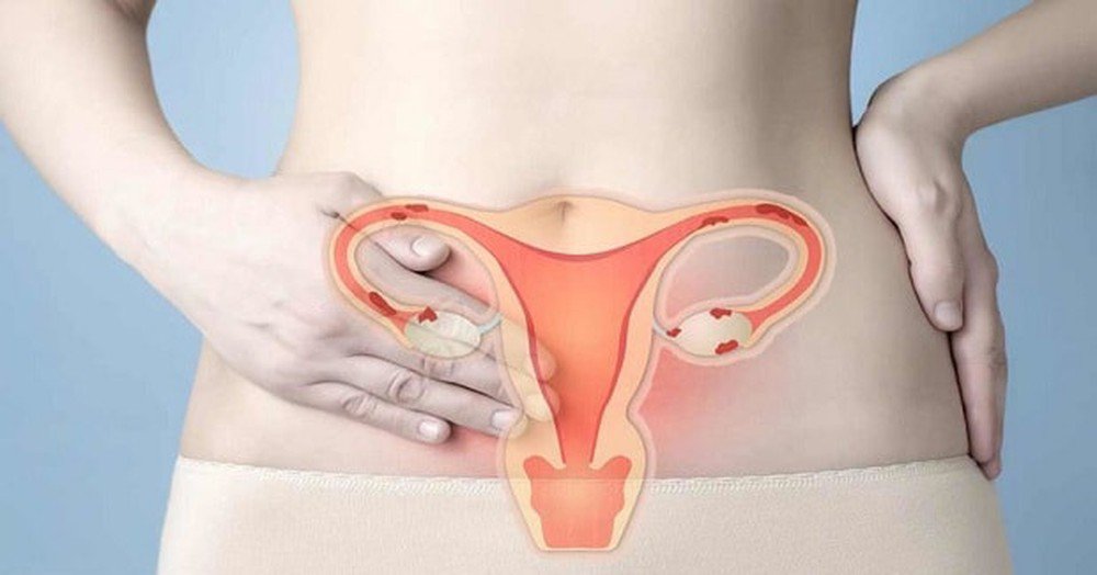 Theo dõi niêm mạc bao nhiêu ngày thì chuyển phôi?