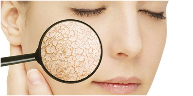 Các loại da và cách chăm sóc: Da thường - khô - nhờn - hỗn hợp - nhạy cảm