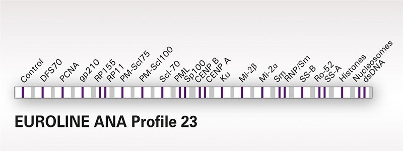 Xét nghiệm 23 kháng thể kháng nhân (ANA 23 Profile)