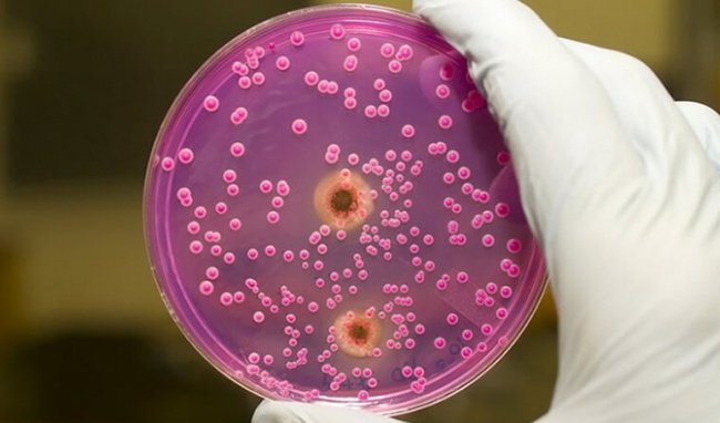 Ý nghĩa xét nghiệm Mycoplasma