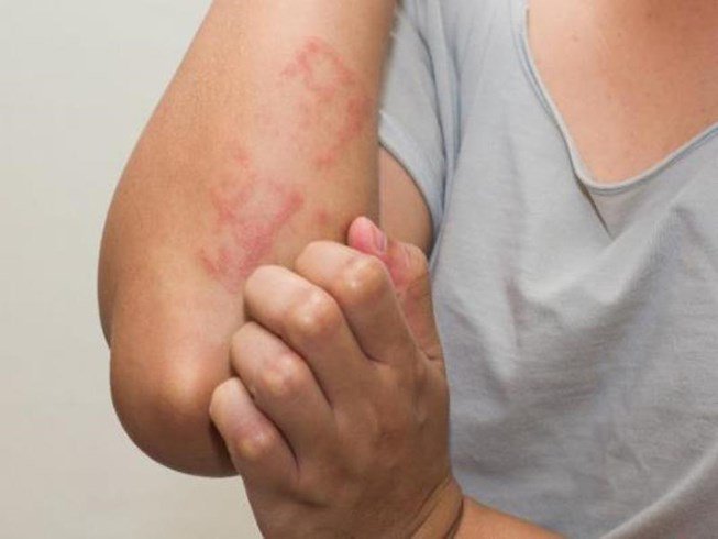 Thuốc Laxative: Công dụng, chỉ định và lưu ý khi dùng