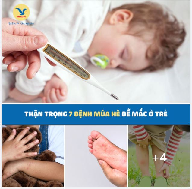 THẬN TRỌNG 7 BỆNH MÙA HÈ DỄ MẮC Ở TRẺ MẸ KHÔNG NÊN CHỦ QUAN