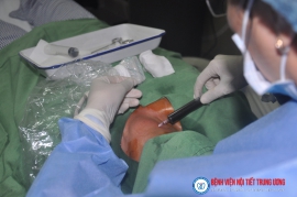 Các phương pháp điều trị bướu cổ - Bệnh viện Nội Tiết Trung ương