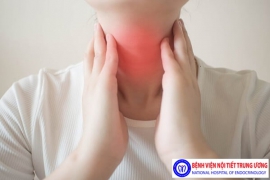 Chẩn đoán và điều trị bệnh Basedow - Bệnh viện Nội Tiết Trung ương